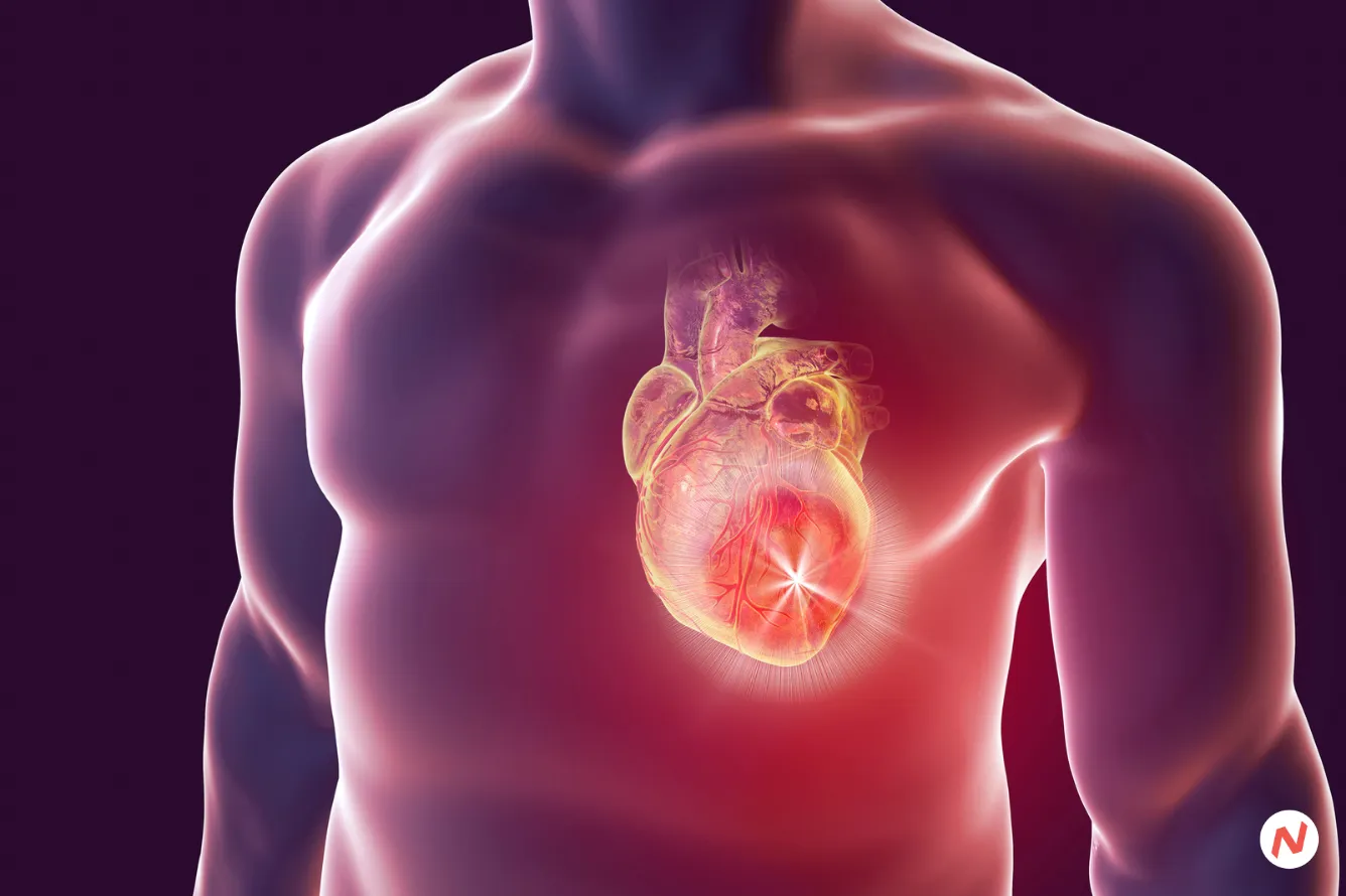 Researchers at Tampere University developing an algorithm to predict sudden cardiac death