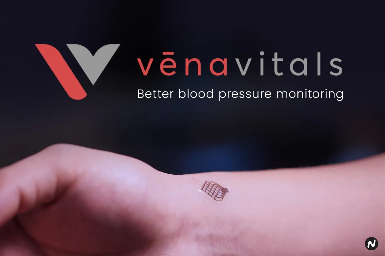 Vena Vitals soft wearable sensor for continuous blood pressure monitoring